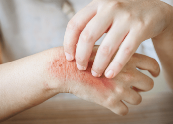 6 thức uống thải độc gan tự nhiên - Thời Báo Việt