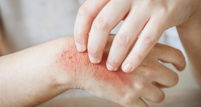 6 thức uống thải độc gan tự nhiên - Thời Báo Việt