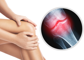 Lợi ích và cách chọn sữa xương khớp cho người tiểu đường - Thời Báo Việt