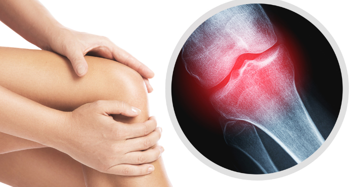 Lợi ích và cách chọn sữa xương khớp cho người tiểu đường - Thời Báo Việt